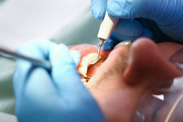 Best Weekend Emergency Dentist in Troutman, NC