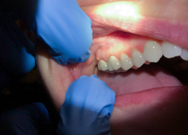 Best Emergency Orthodontic Repairs in Troutman, NC