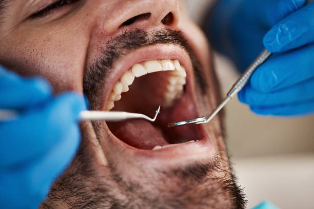 Best Emergency Treatment for Toothache in Troutman, NC