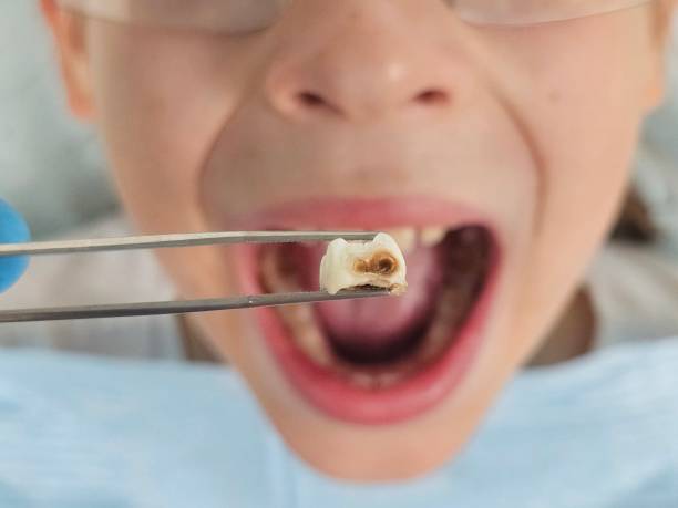 Best Same-Day Emergency Dentist in Troutman, NC