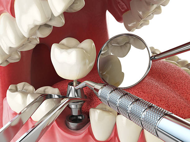 Best Emergency Dental Care for Trauma or Injury in Troutman, NC